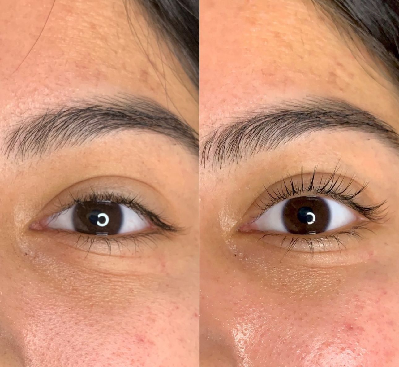 Renewed Med Spa & Tanning - Facility Photo