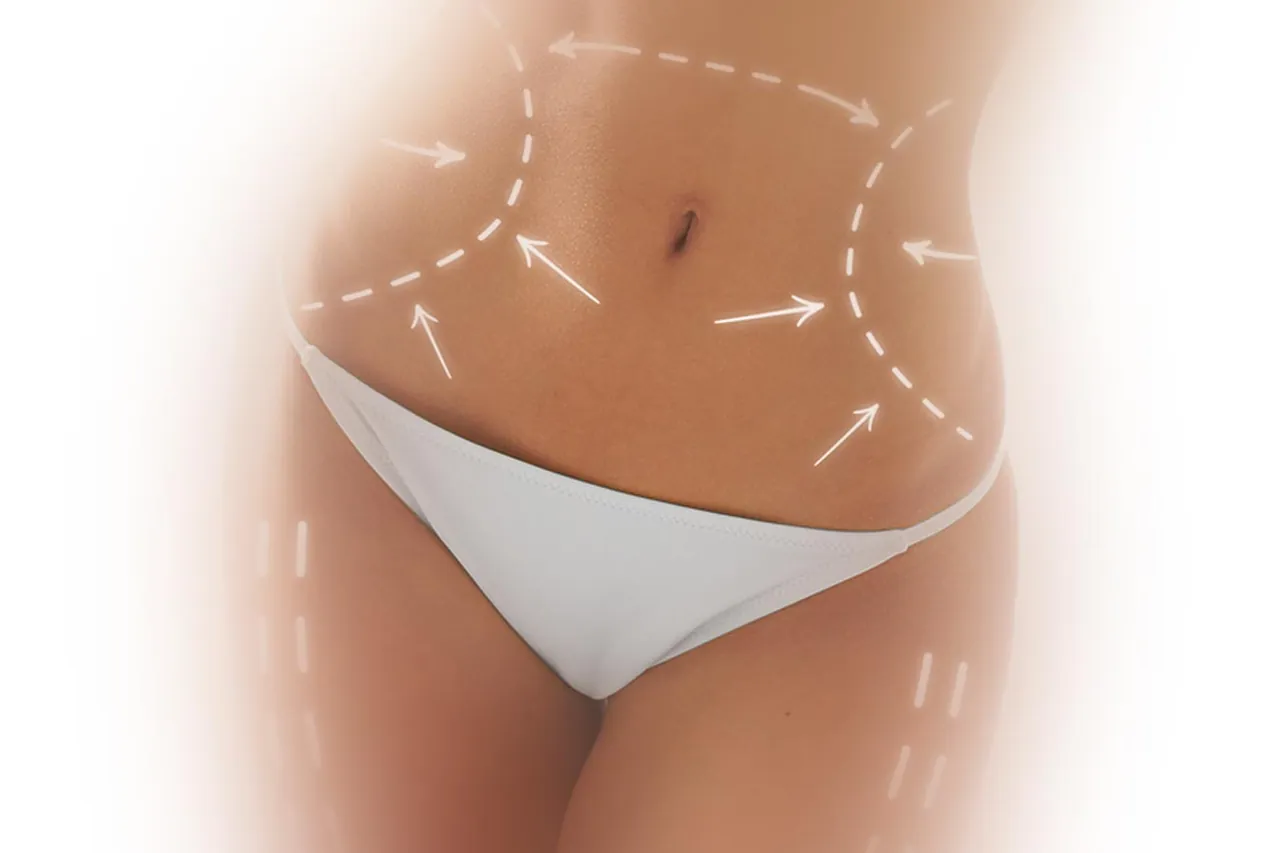 Body Contouring